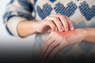 Eczema, Psoriasis